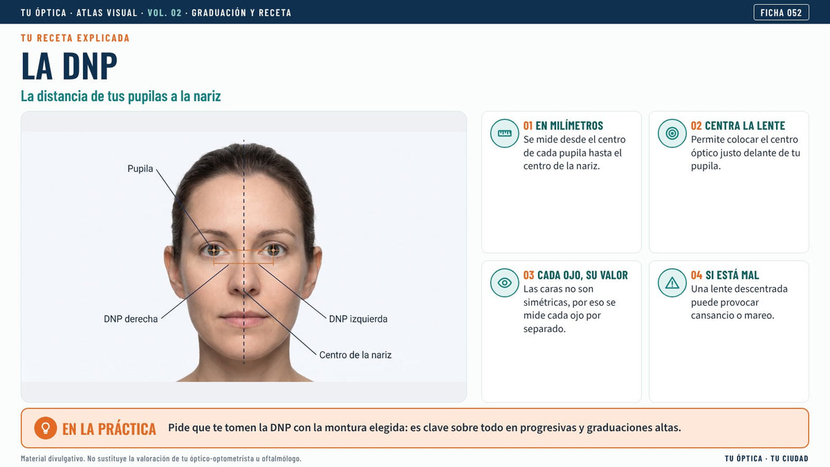 Ficha de la distancia nasopupilar (DNP)