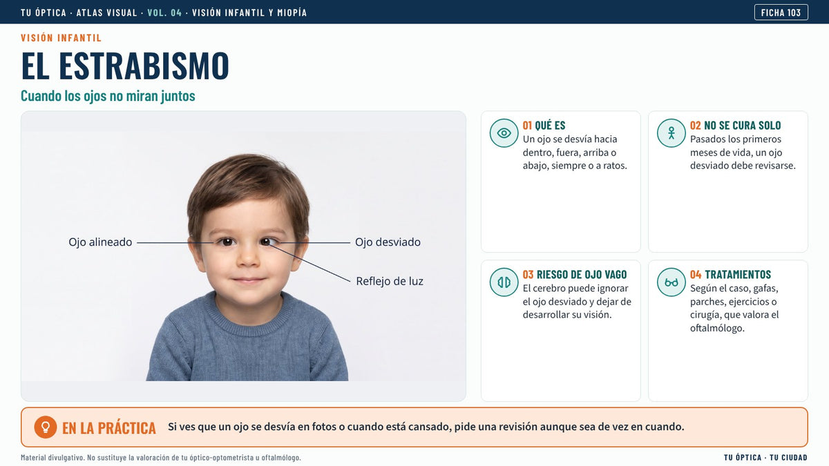 Ficha del estrabismo infantil
