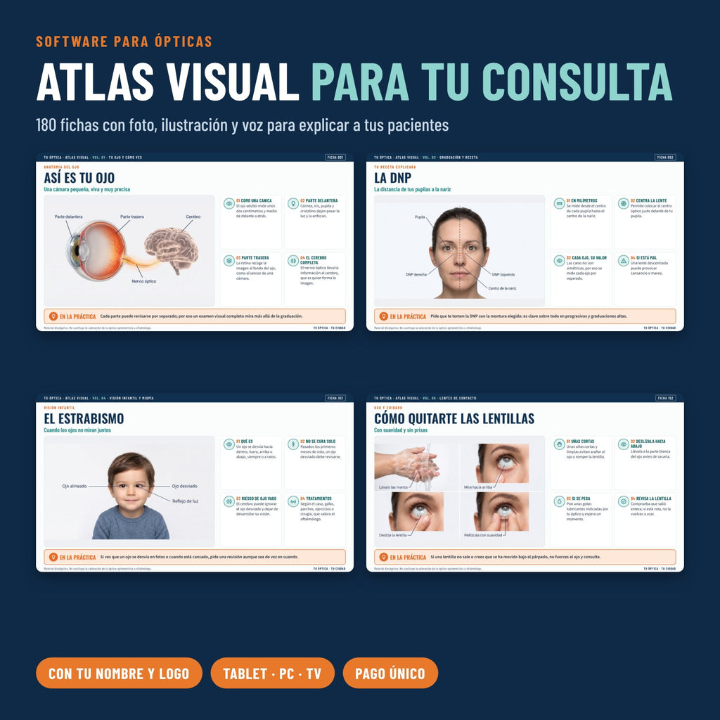 Atlas Visual para ópticas: 180 fichas para explicar en consulta